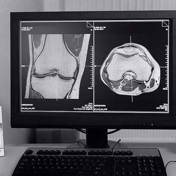 Densitometria-Óssea Densitometria-Óssea